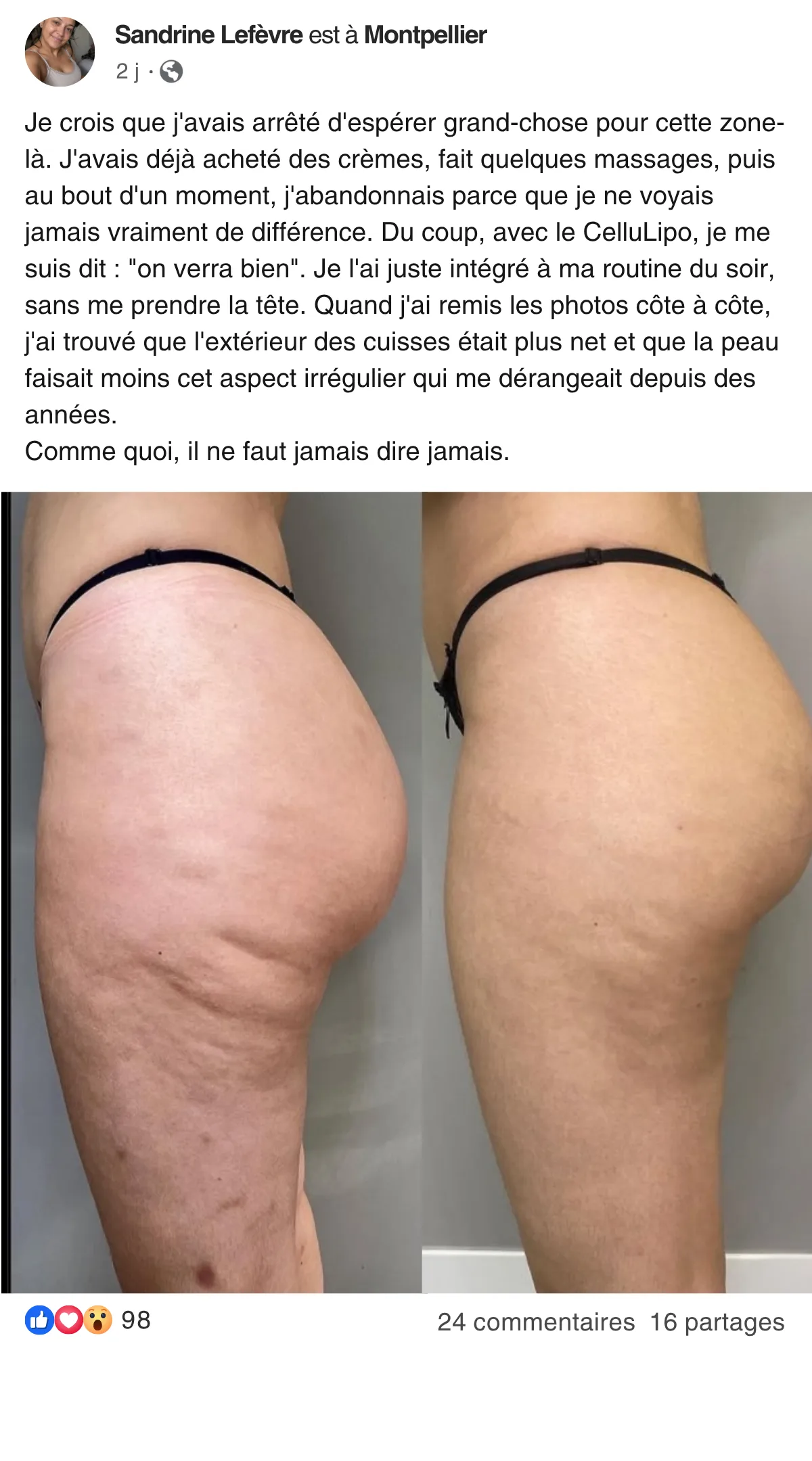 BRASIL (25)